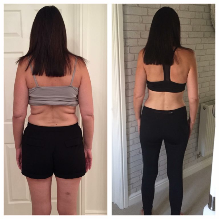julie roberts before and after photo