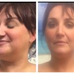 liz before and after picture