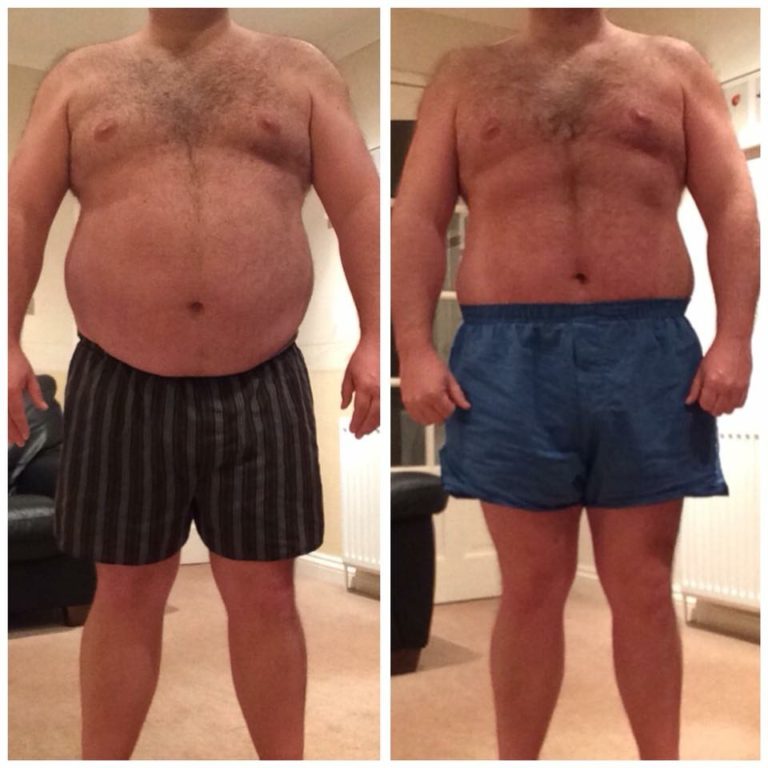 mr x before and after picture