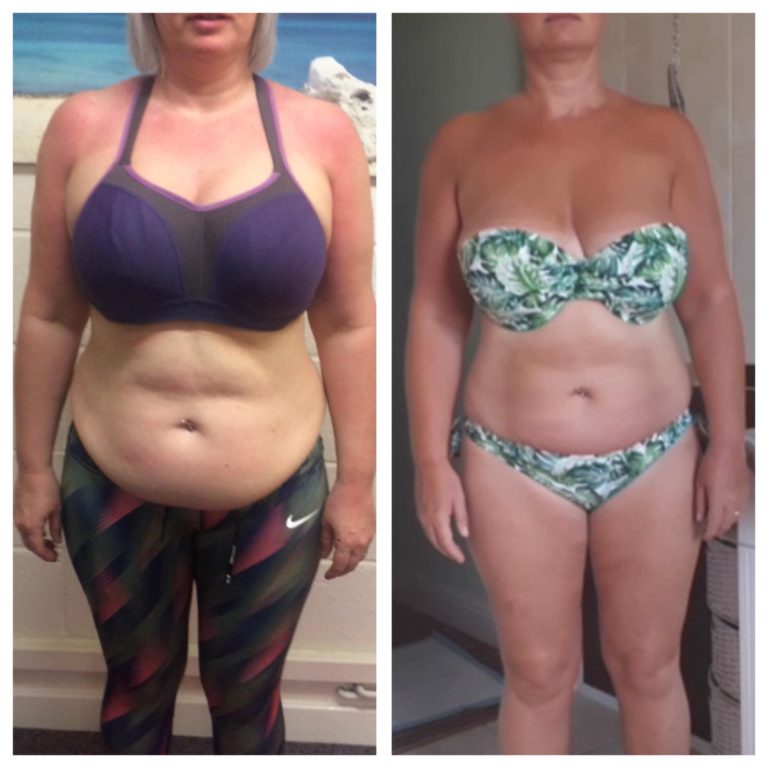 miss x before and after picture