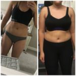 ms x before and after picture